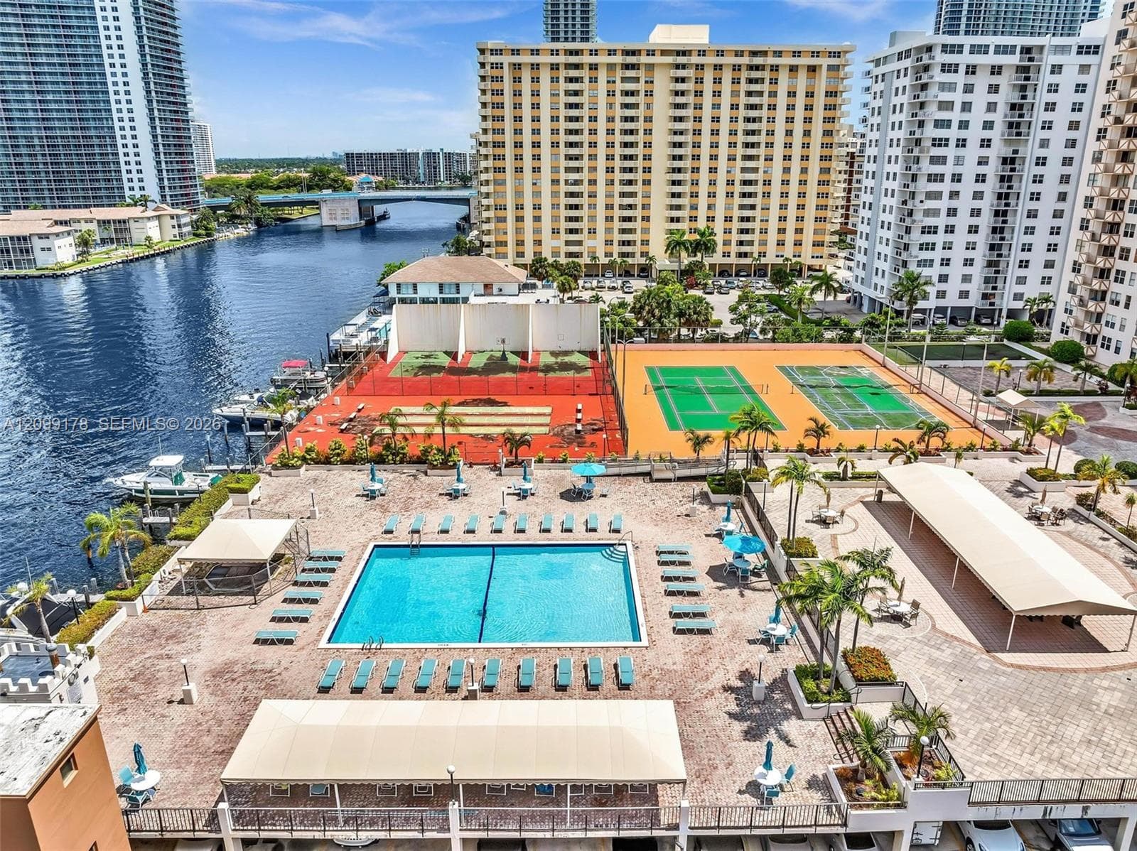 Intercostal 2